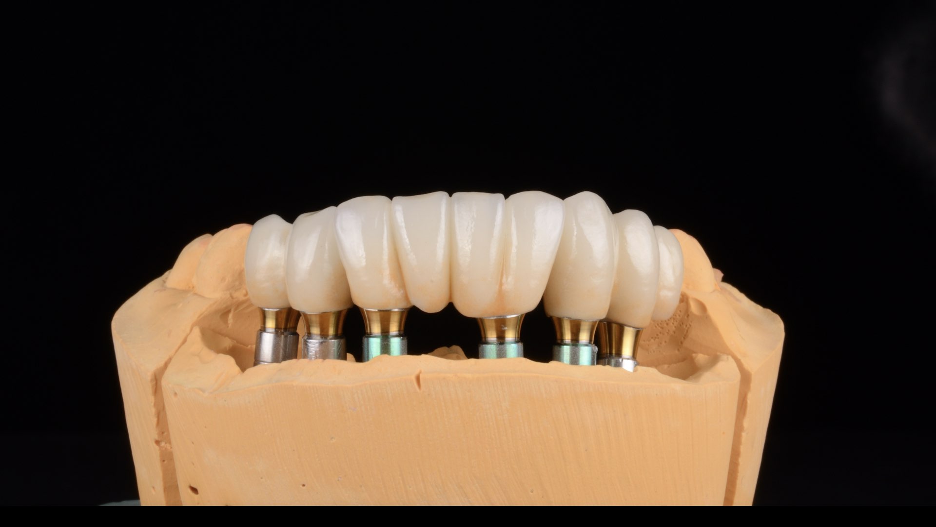 Come prendersi cura degli impianti dentali?