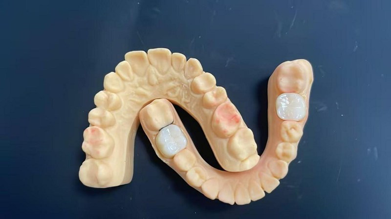 Qual è il bordo della spalla?