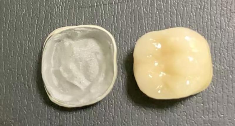 WM DENTAL LAB – Un laboratorio odontoiatrico leader in Cina