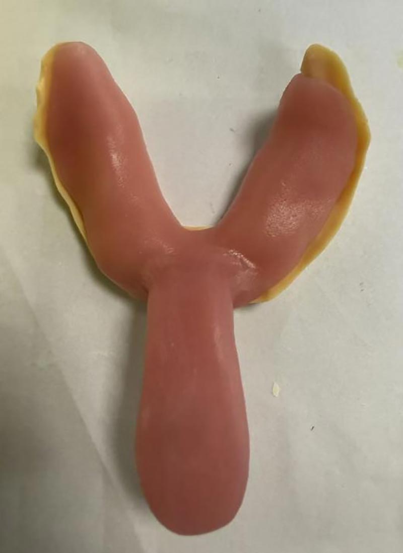 Cose che non sapevi sui vassoi dentali personalizzati