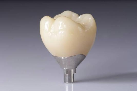 Ottimizza i tuoi risultati con restauri in zirconio (corone, ponti, impianti)