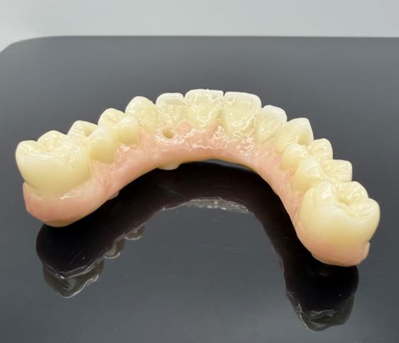 Materiali comuni per corone e ponti dentali