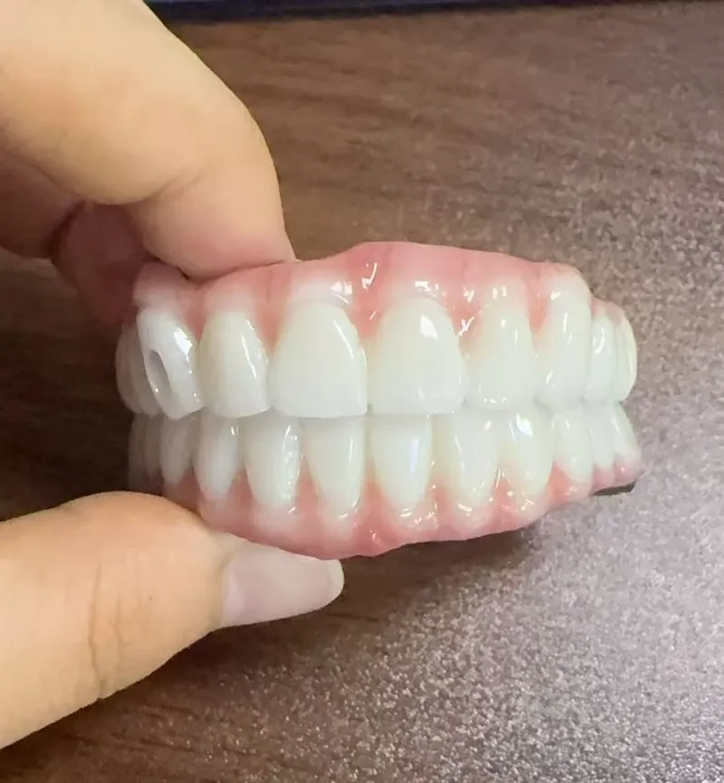 Pericoli di malocclusione