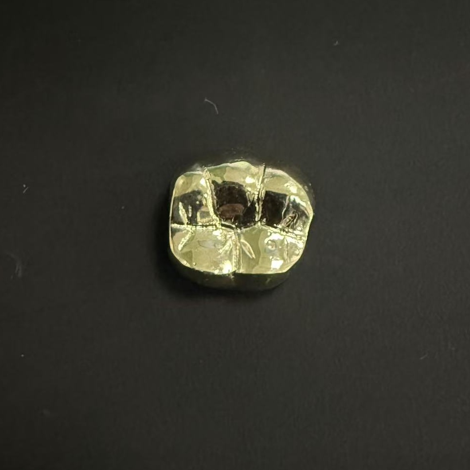 Gold Crown