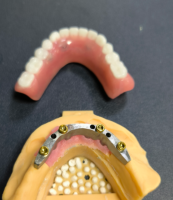 Localizzatore e barra dentale